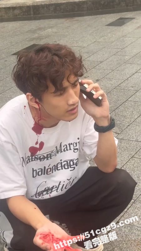 杭州网络乞丐男模江江 恶心狗皮膏药男 给大姐推荐男模没相中 一个月后索要发单费 被大姐找人爆头开瓢-51吃瓜网